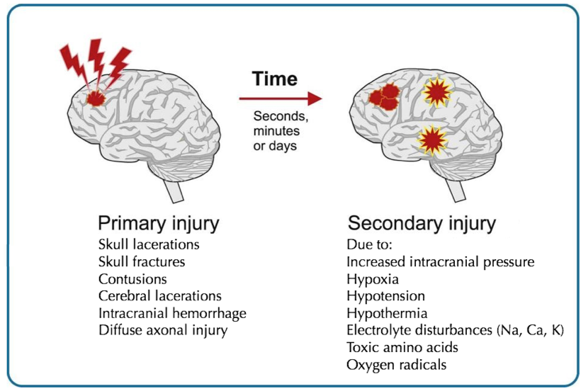 Brain injury Pathophysiology.